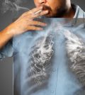 How Curcumin May Reverse Tobacco Induced Damage In Lungs | www.curcuminhealth.info